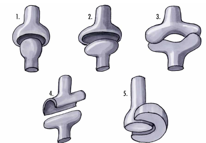 classification des diarthroses