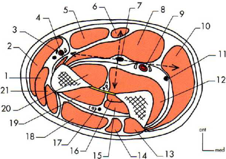 Cours anatomie 1ere année medecine: Nerf médian et musculocutané 11 Cours-gratuit-Coupe horizontale passant par le tiers superieur de l avant bras 1