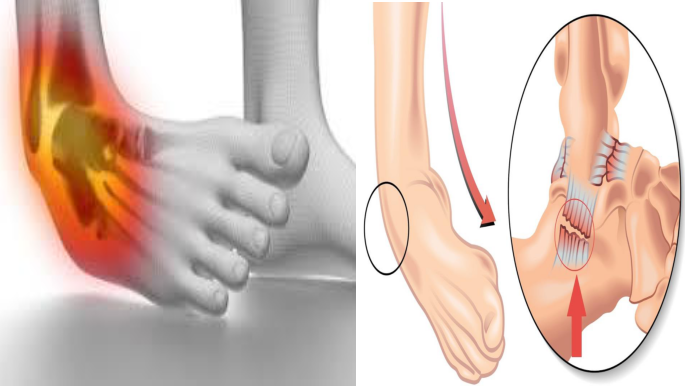 Cours anatomie 1ere année medecine : Articulation talo-crurale 22 Cours-gratuit-Ligament talo fibulaire anterieur