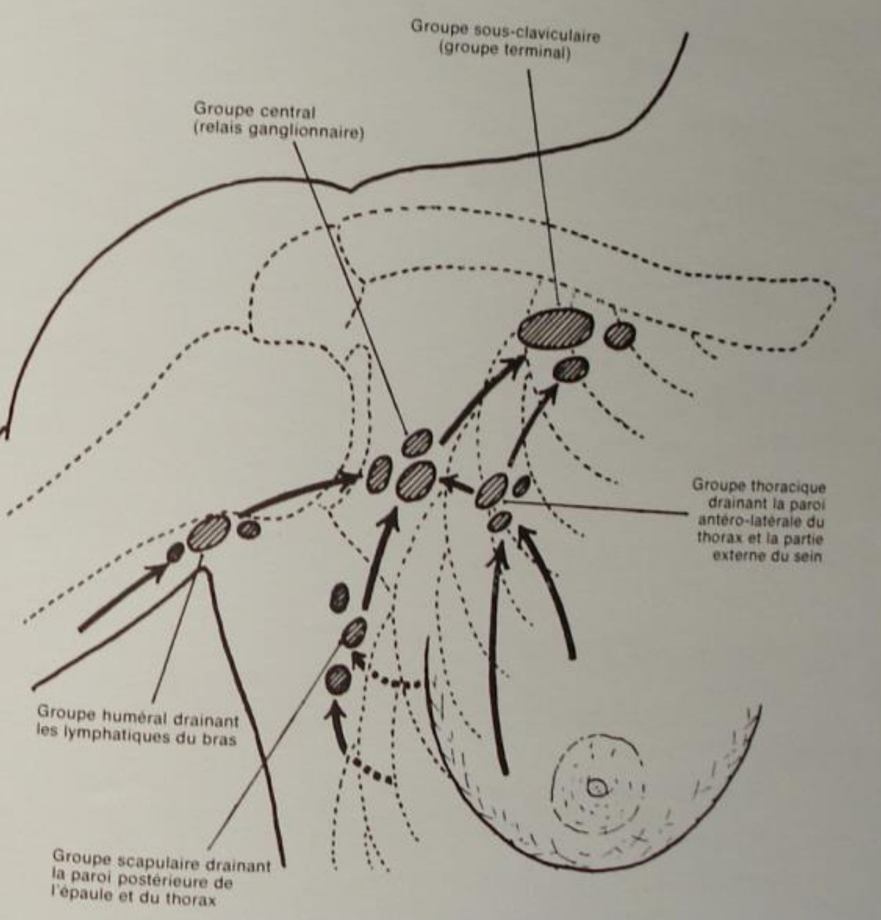 Lymphonoeuds profonds ( Fosse axillaire)