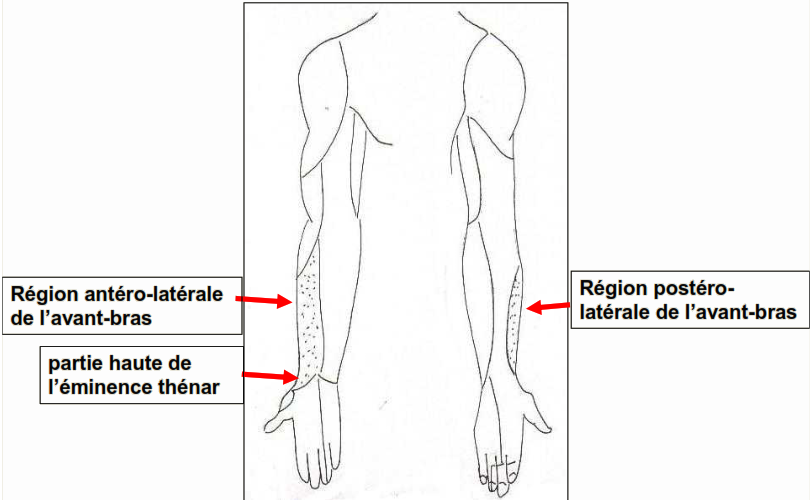 Cours anatomie 1ere année medecine: Nerf médian et musculocutané 45 Cours-gratuit-Nerf musculo cutane territoires cutanes sensitifs a l avant bras 1