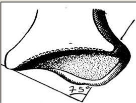 Cours anatomie 1ere année medecine : Articulation talo-crurale 6 Cours-gratuit-Surface articulaire malleolaire tibiale