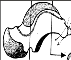 Cours anatomie 1ere année medecine : Articulation talo-crurale 13 Cours-gratuit-Surface malleolaire mediale du talus