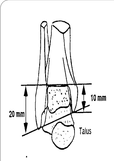 Cours anatomie 1ere année medecine : Articulation talo-crurale 10 Cours-gratuit-Vue anterieure de l articulation talo crurale
