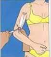Cours anatomie 1ere année medecine: Nerf médian et musculocutané 49 affaiblissement de la flexion du coude et de la supination de l’avantbras
