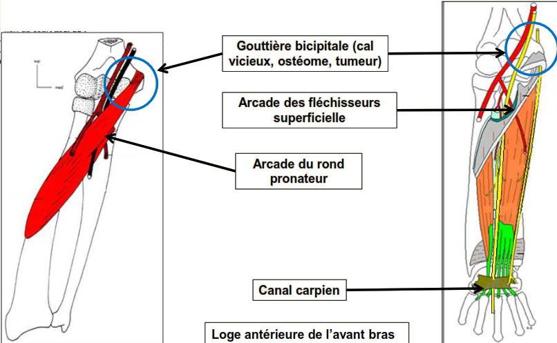 Cours anatomie 1ere année medecine: Nerf médian et musculocutané 28 Cours-gratuit-anatomie clinique PAR COMPRESSION au niveau 1