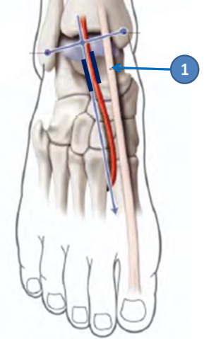 Cours anatomie 1ere année medecine : Artères dorsales de la jambe artères du pied 28 Cours-gratuit-artere dorsale du pied est accompagnee de ses deux veine satellites