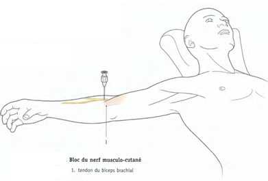 Cours anatomie 1ere année medecine: Nerf médian et musculocutané 42 Cours-gratuit-bloc du nerf musculo cutane 1