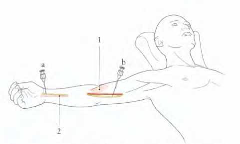 Cours anatomie 1ere année medecine: Nerf médian et musculocutané 7 Cours-gratuit-bord medial du tendon du muscle biceps et l artere brachiale 1