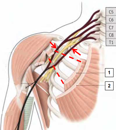 Cours anatomie 1ere année medecine: Nerf médian et musculocutané 2 Cours-gratuit-la fosse