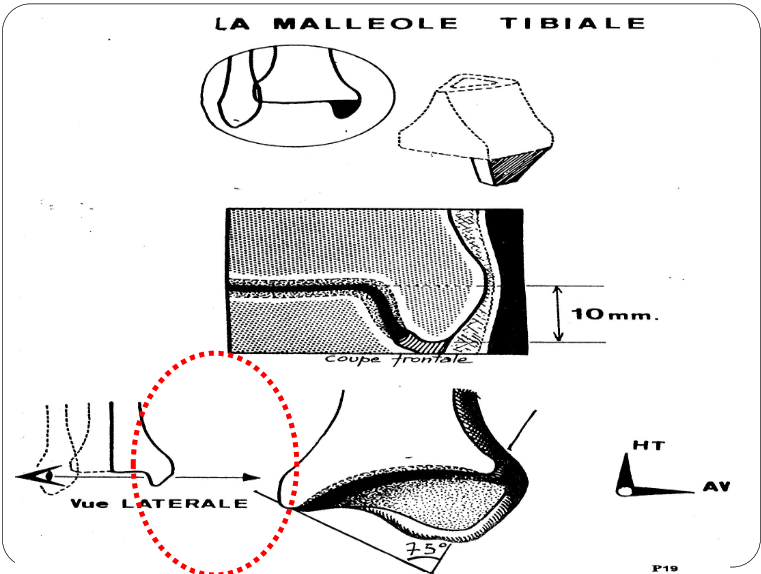 Cours anatomie 1ere année medecine : Articulation talo-crurale 7 la malleole tibiale Articulation talo-crurale