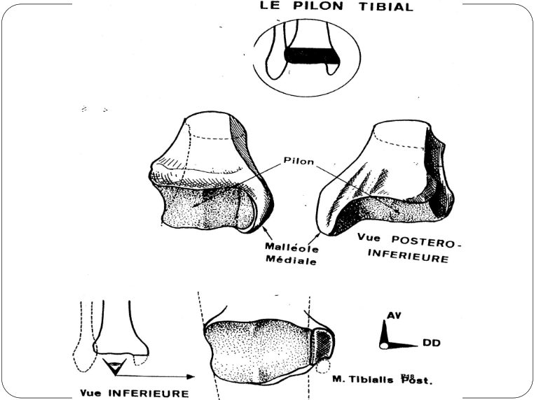 Cours anatomie 1ere année medecine : Articulation talo-crurale 5 le pilon tibial Articulation talo-crurale