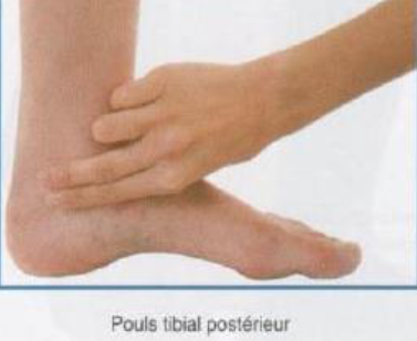 Cours anatomie 1ere année medecine : Artères dorsales de la jambe artères du pied 13 Cours-gratuit-le pouls tibial posterieur