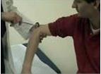 reflexe tricipital c7