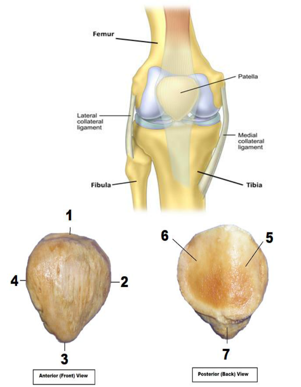 Condyles fémoraux-anatomie du genou