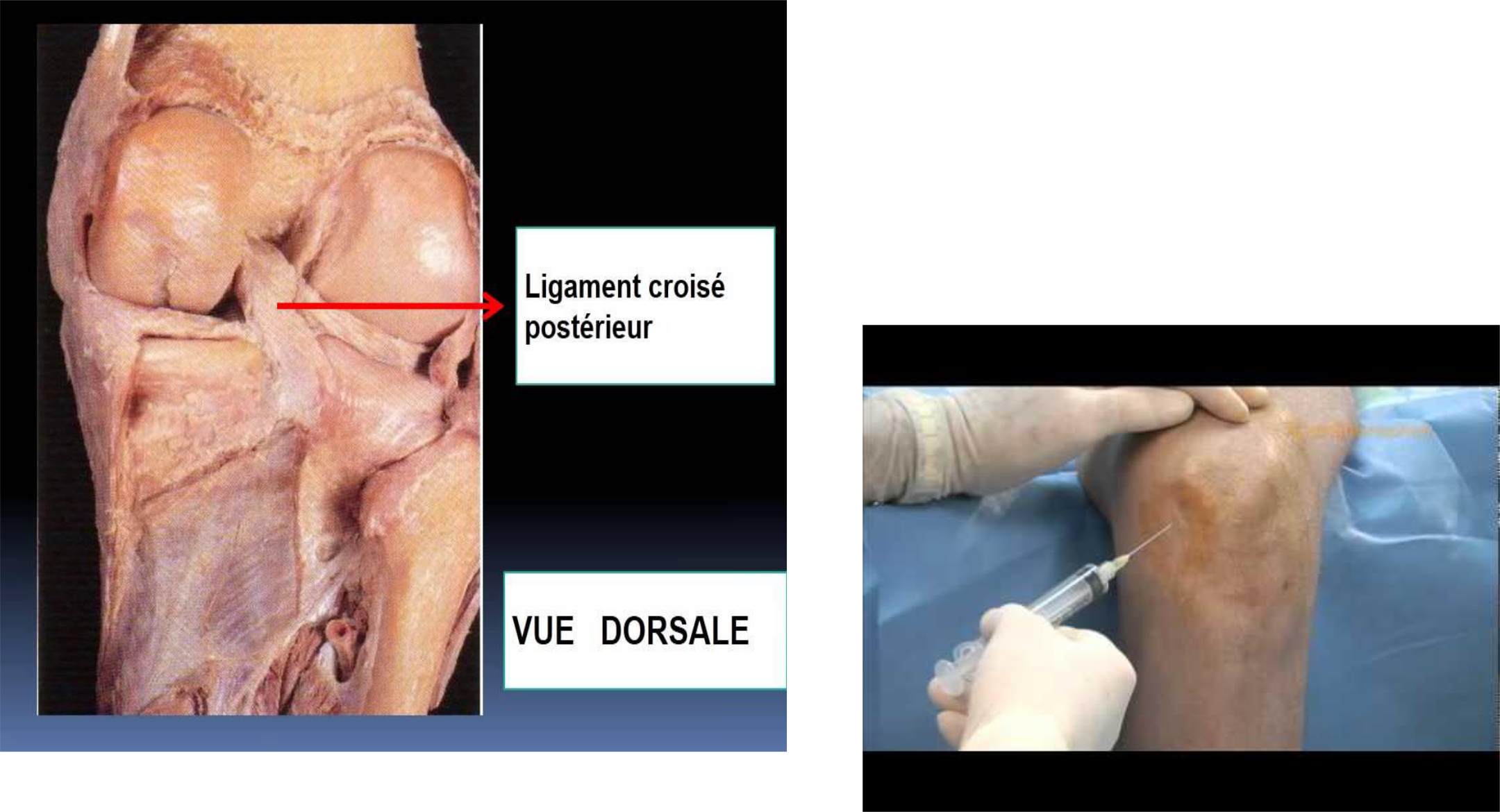 Image cadavérique