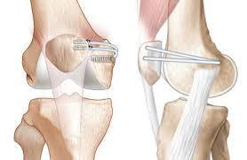 Anatomie clinique