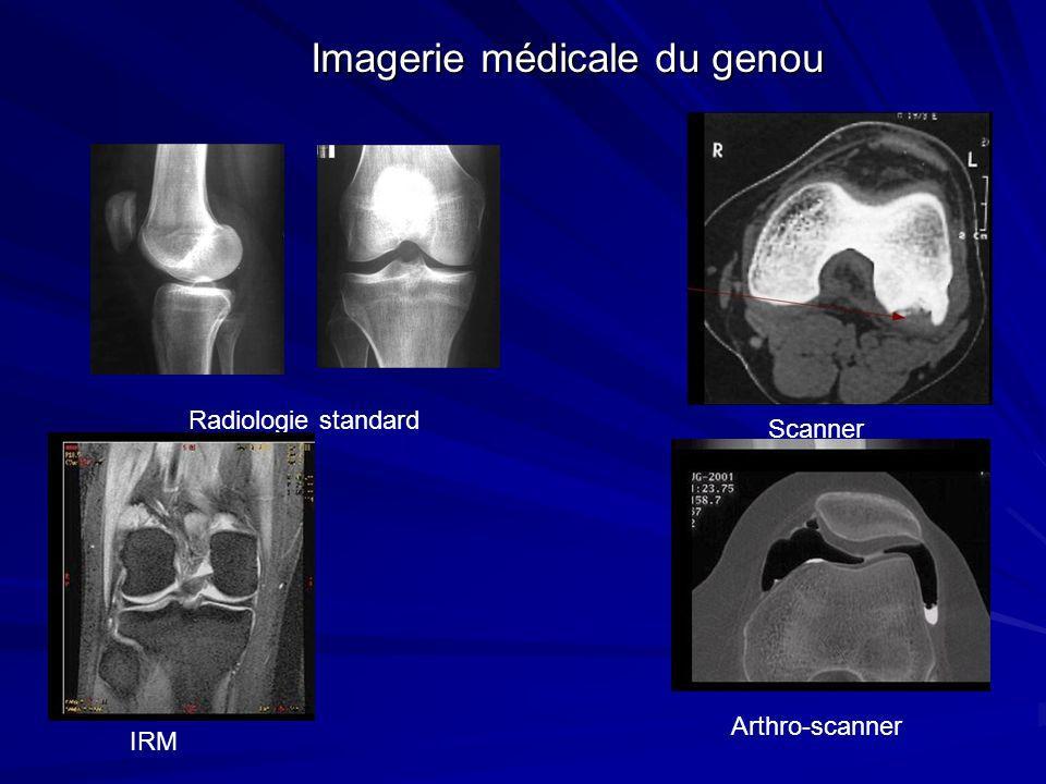 Imagerie du genou